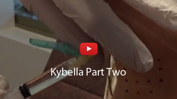 Kybella Video Testimonials 2