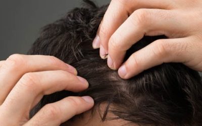 How NeoGraft hair transplants are performed