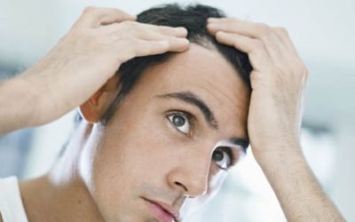 NeoGraft Hair Transplants Guide Part 1 – What is NeoGraft and who is a good candidate?